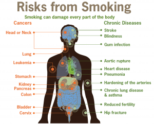 Risks from Smoking diagram