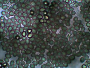 A picture showing the true color of black mold (rhizopus sp) spores, which is green using Light Microscope